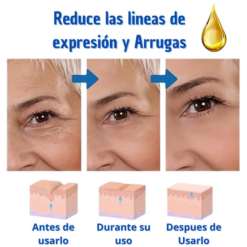 Suero Botox Anti Arrugas - TIMELESS